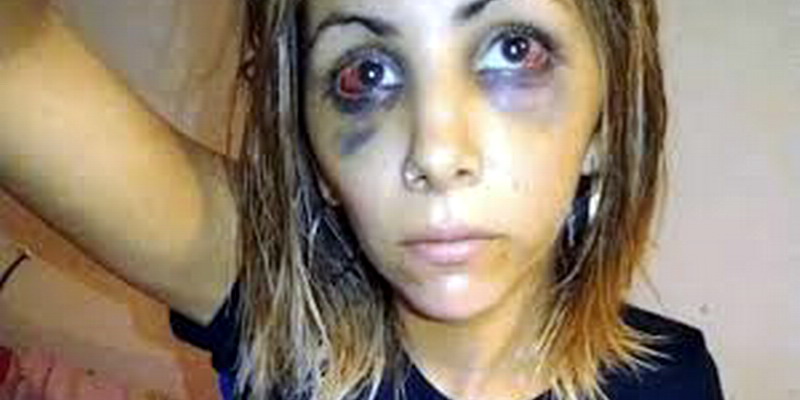 Golpeó con brutalidad a su ex luego de verla hablando con un amigo: «Agradecé que no te pegué un tiro»