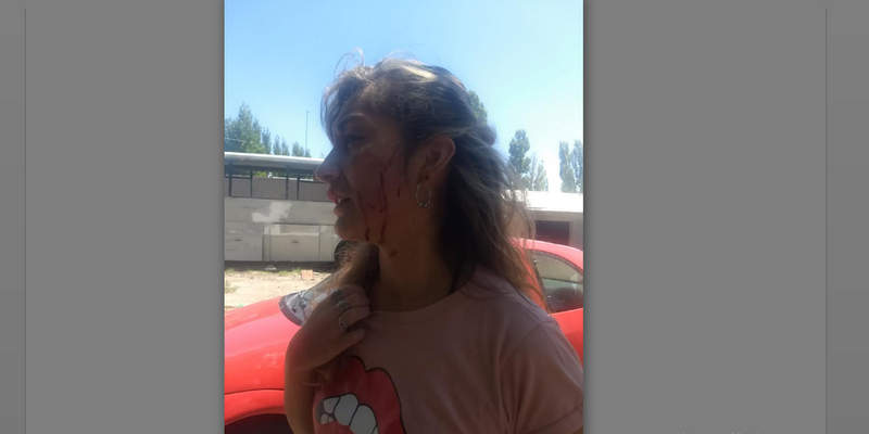 Le tiraron la camioneta encima, se salvó de milagro y busca al responsable