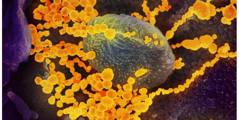 Misterio en EEUU: investigan el caso de un infectado con coronavirus que no viajó ni tuvo contacto con ningún enfermo