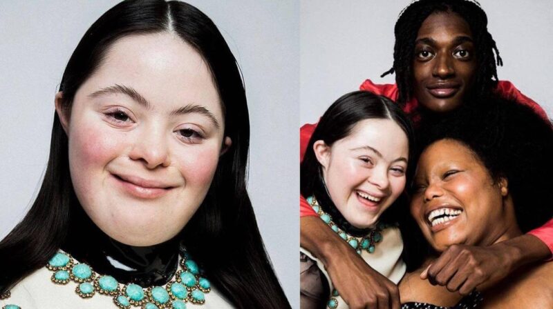 Una modelo con síndrome de Down hace historia en la nueva campaña de Gucci