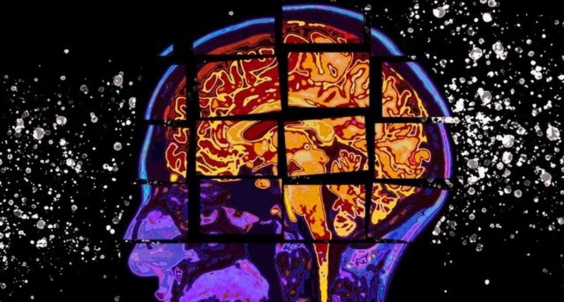 ¿Qué pasa en el cerebro cuando estamos muriendo?
