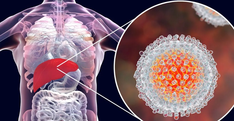 Detectaron el primer caso argentino de hepatitis aguda grave de origen desconocido