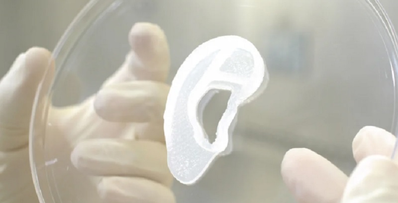 Lograron trasplantar una oreja impresa en 3D hecha de células humanas