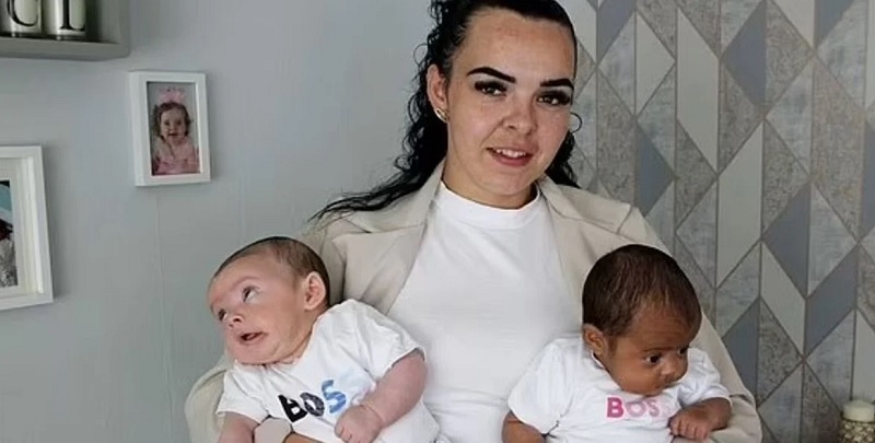 Dio a luz a gemelos con distinto color de piel: qué ocurrió La madre quedó atónita al ver a sus hijos.