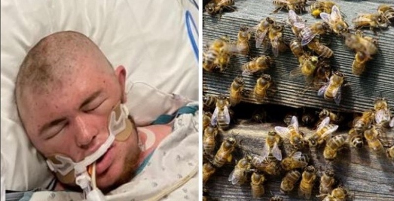 Sobrevivió de milagro tras ser picado 20 mil veces por abejas asesinas africanas