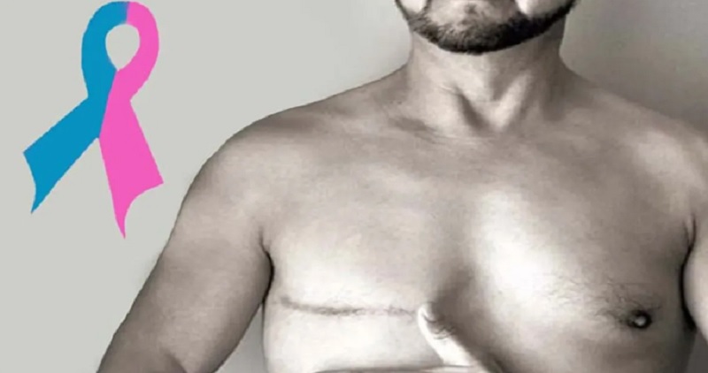 El cáncer de mama también es cosa de hombres
