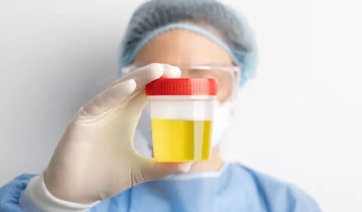 Qué dice el color de la orina sobre la salud y cuándo conviene consultar