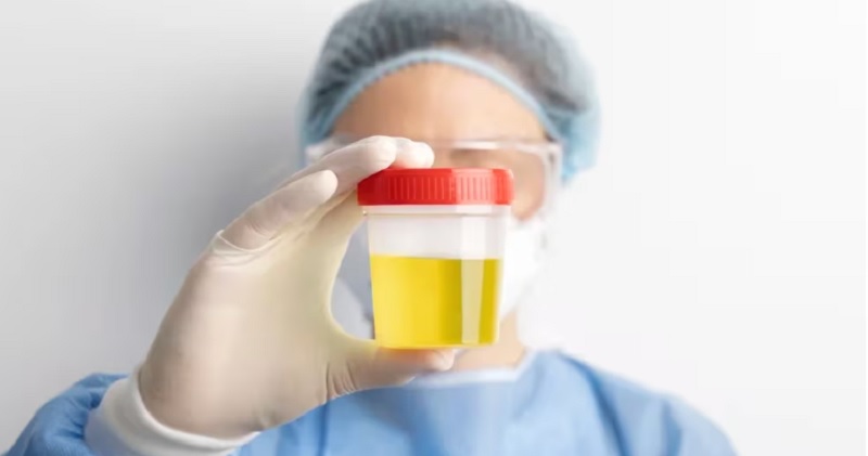 Por qué el color de la orina es un indicador clave sobre la salud de una persona