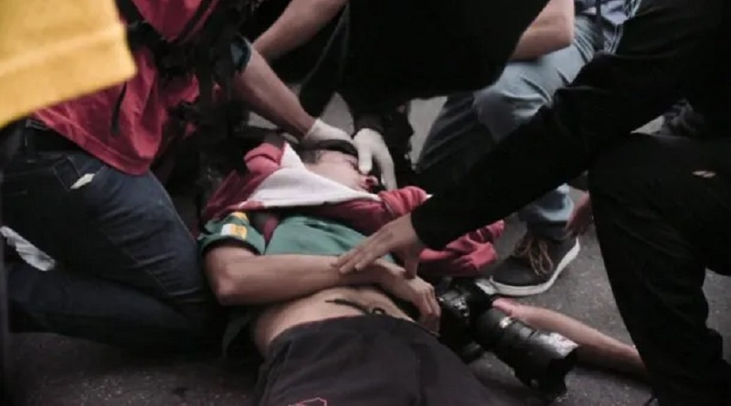 Golpearon con un cartucho de gas a un fotógrafo, que está en grave estado. CONTENIDO SENSIBLE.