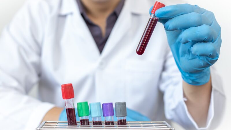 Diagnóstico de anemia: el rol clave del laboratorio y un enfoque multidisciplinario