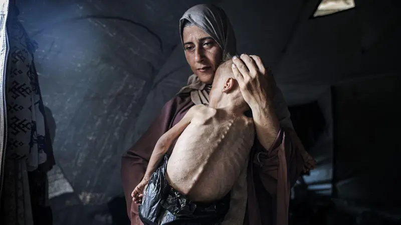 La historia de la foto de Hedaya y su bebé, una de las imágenes más impactantes de la hambruna en Gaza