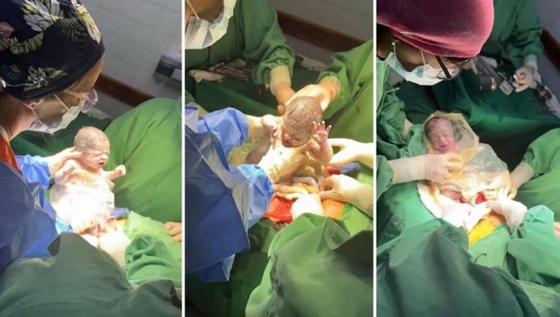 Nacieron trigemelas en Chubut, un “milagro” que ocurre una vez cada millones de embarazos